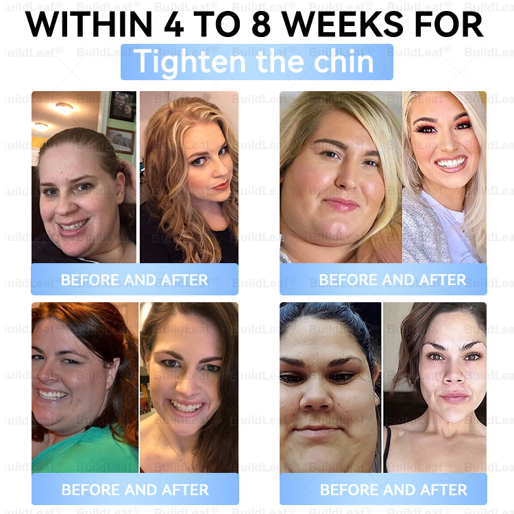 BuildLeaf® Only 10 boxes!!! Get an exclusive 30% OFF now. ✨ See visible slimming in just 7 days! ✔️ Backed by our 180-day money-back guarantee.