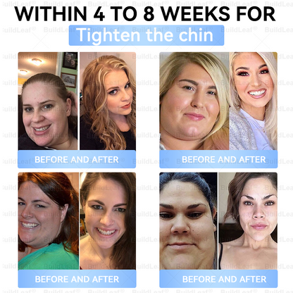 BuildLeaf® Only 10 boxes!!! Get an exclusive 30% OFF now. ✨ See visible slimming in just 7 days! ✔️ Backed by our 180-day money-back guarantee.