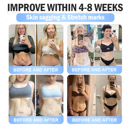 BuildLeaf® Only 10 boxes!!! Get an exclusive 30% OFF now. ✨ See visible slimming in just 7 days! ✔️ Backed by our 180-day money-back guarantee.