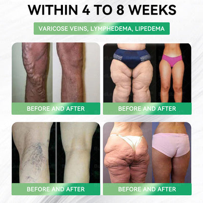 🛒𝑩𝒖𝒊𝒍𝒅𝑳𝒆𝒂𝒇® Only 10 boxes!!! Get an exclusive 30% OFF now. ✨ See visible slimming in just 7 days! ✔️ Backed by our 180-day money-back guarantee.
