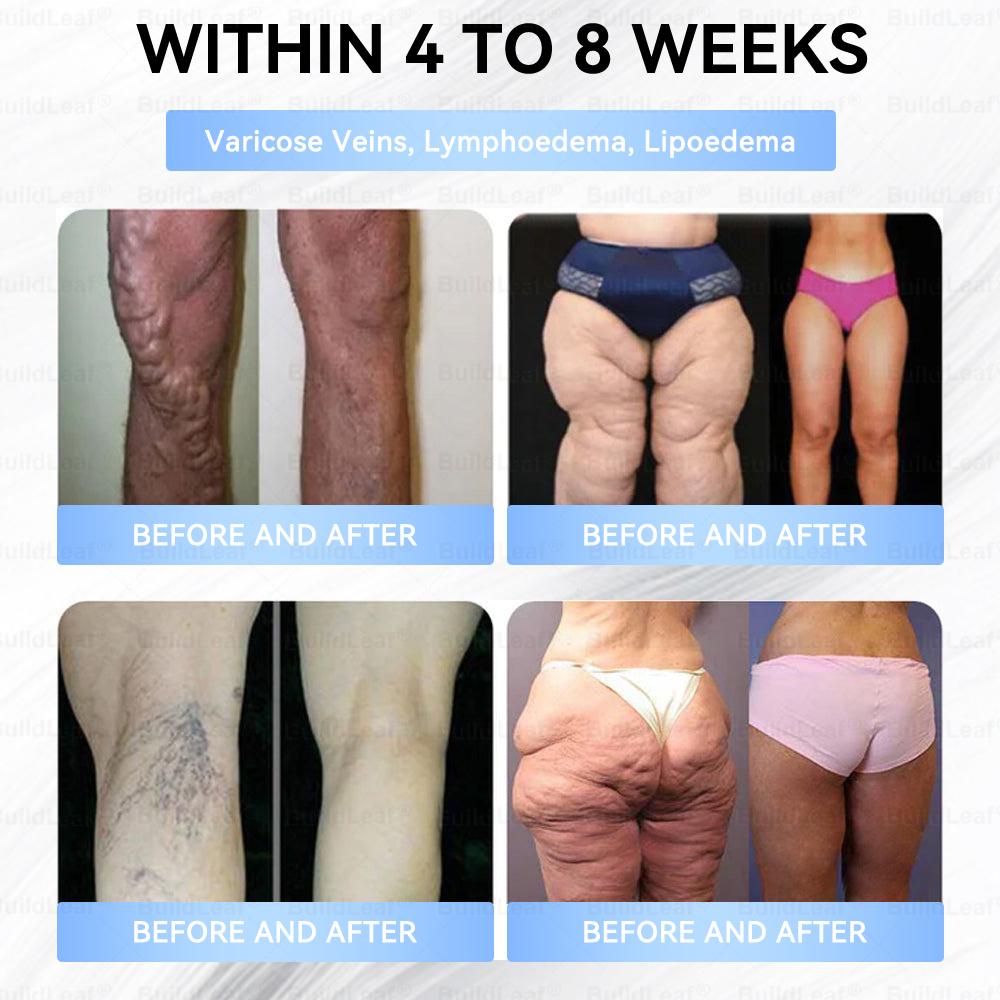 BuildLeaf® Only 10 boxes!!! Get an exclusive 30% OFF now. ✨ See visible slimming in just 7 days! ✔️ Backed by our 180-day money-back guarantee.