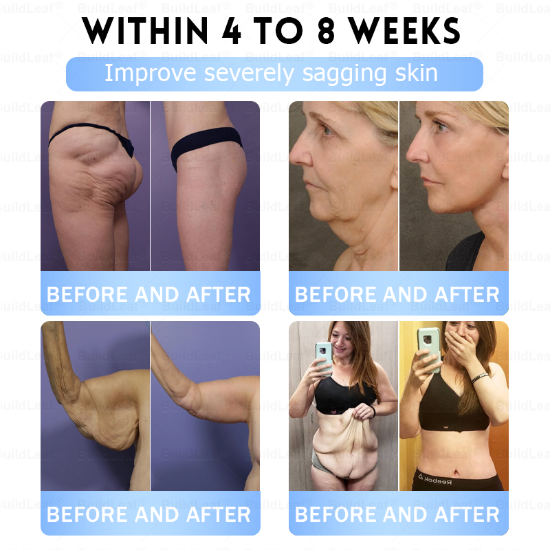 BuildLeaf® Only 10 boxes!!! Get an exclusive 30% OFF now. ✨ See visible slimming in just 7 days! ✔️ Backed by our 180-day money-back guarantee.