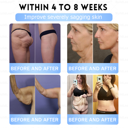 BuildLeaf® Only 10 boxes!!! Get an exclusive 30% OFF now. ✨ See visible slimming in just 7 days! ✔️ Backed by our 180-day money-back guarantee.